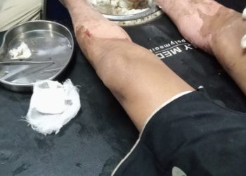 Kebakaran Rumah di Gelumbang Terdapat Tiga Orang Alami Luka Terbakar